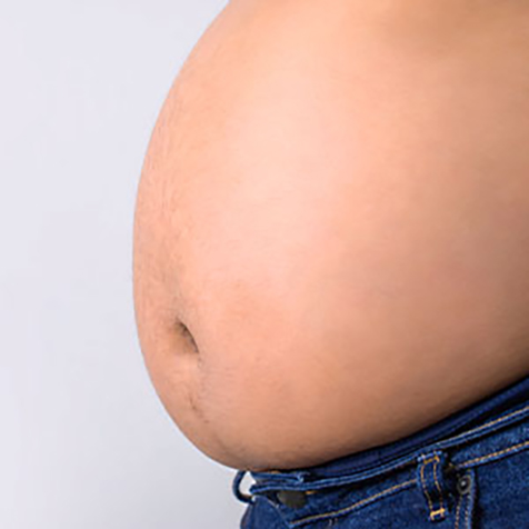 Image of patient struggling with Beer Belly