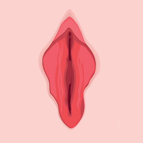 Image of patient struggling with Labia Tightening