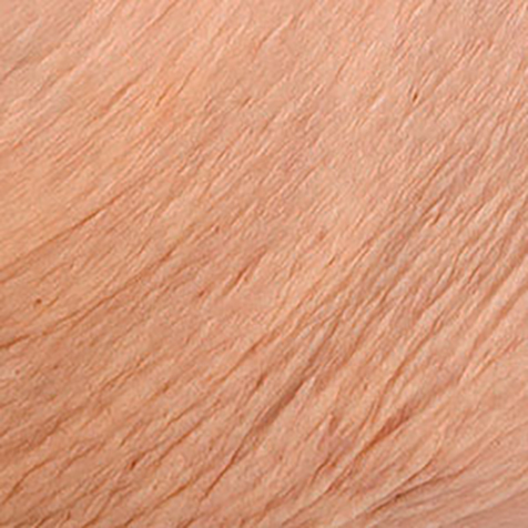 Image of patient struggling with Loose Skin