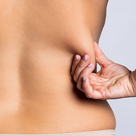 Image of patient struggling with Love Handles