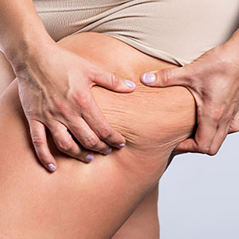 Image of patient struggling with Saddle Bags