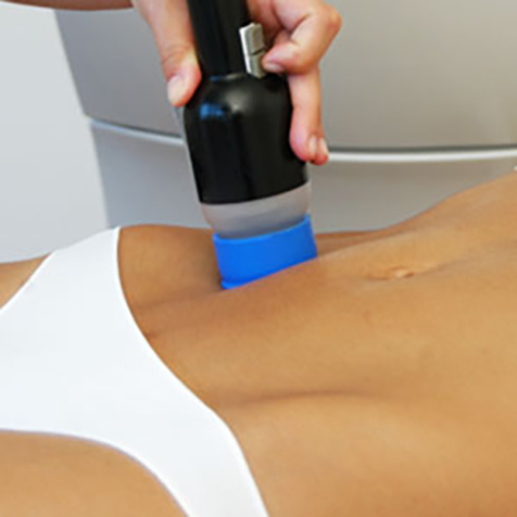 Treat bat wings with our Vaser® Shape at SF Bay Cosmetic Surgery Medical Group in San Ramon