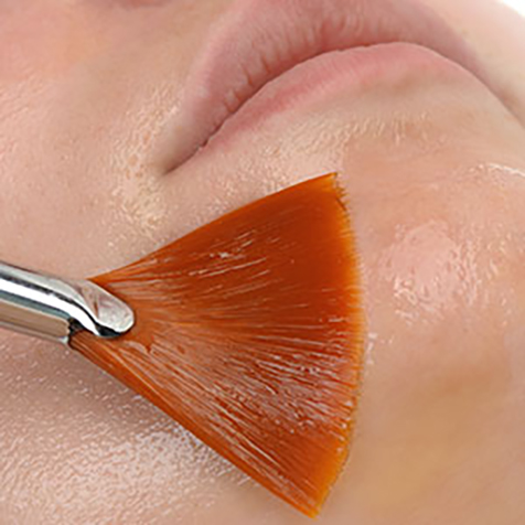 Treat Hyperpigmentation with our Chemical Peels at SF Bay Cosmetic Surgery Medical Group in San Ramon