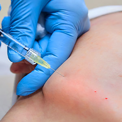 Treat Jowls with our Kybella® at SF Bay Cosmetic Surgery Medical Group in San Ramon