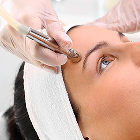 Treat Hyperpigmentation with our Microdermabrasion at SF Bay Cosmetic Surgery Medical Group in San Ramon