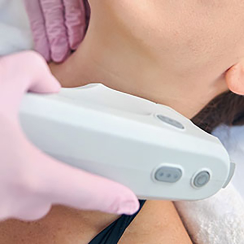 Treat Wrinkles with our Ultherapy® at SF Bay Cosmetic Surgery Medical Group in San Ramon