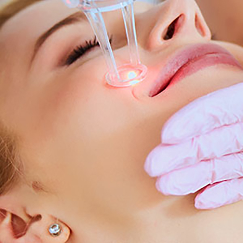 Treat Hyperpigmentation with our UltraPulse® CO2 at SF Bay Cosmetic Surgery Medical Group in San Ramon