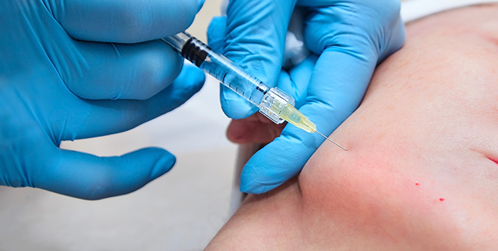 Provider injecting Kybella into a patient's chin area to reduce submental fat